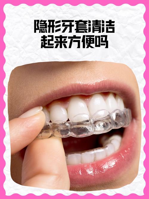 北京口腔医院隐形牙套效果怎么样?
