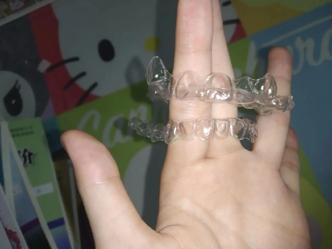 北京口腔医院隐形牙套效果怎么样?