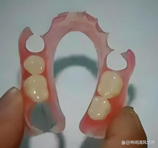 北京口腔医院隐形牙套效果怎么样?