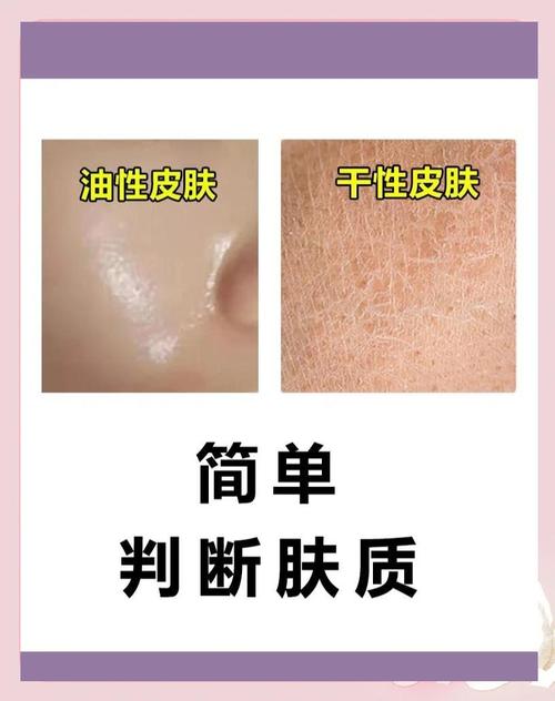 皮肤干油性怎么判断?