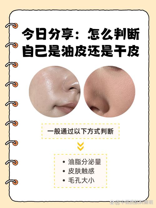 皮肤干油性怎么判断?
