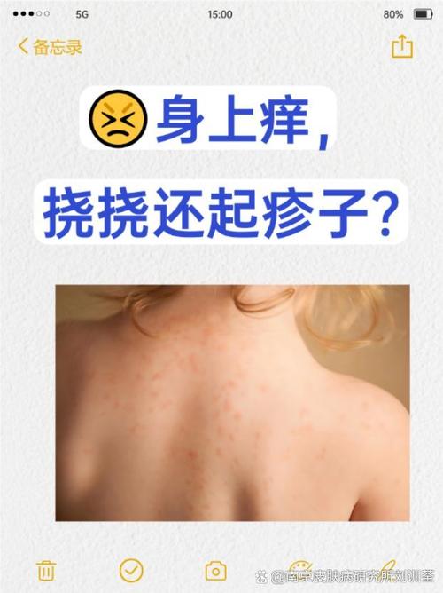 皮肤瘙痒,到底什么原因引起的?