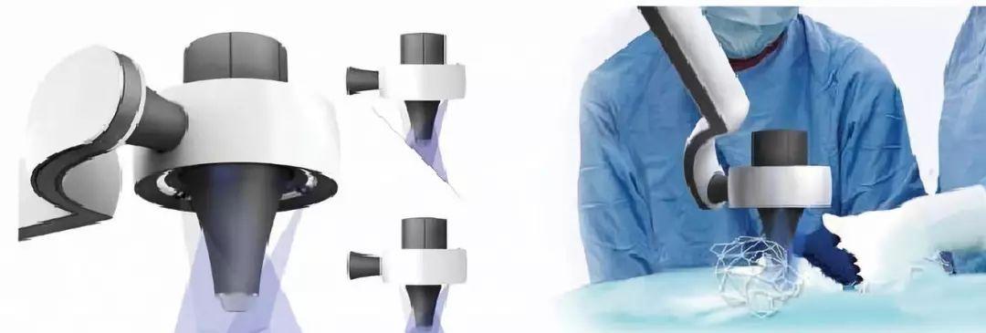 皮肤移植一厘米费用受哪些因素影响?