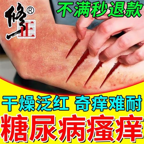 血糖高会引起皮肤痒吗