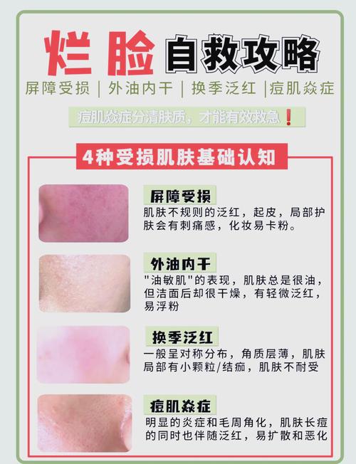 皮肤火辣辣烧灼怎么治