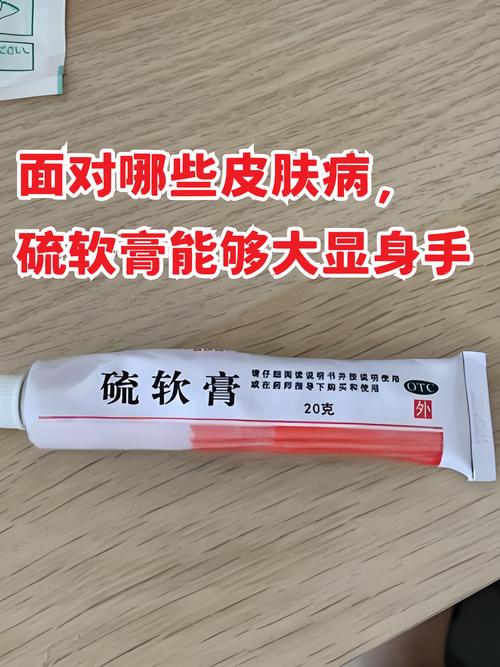 老人皮肤痒,哪种药膏最有效?