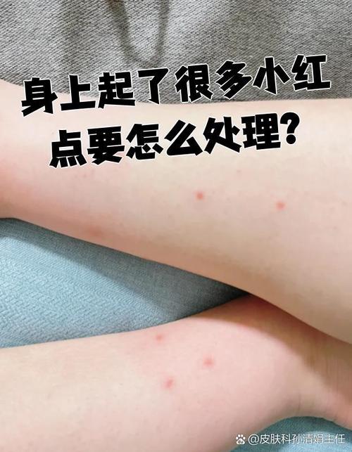 全身皮肤起小红点很痒