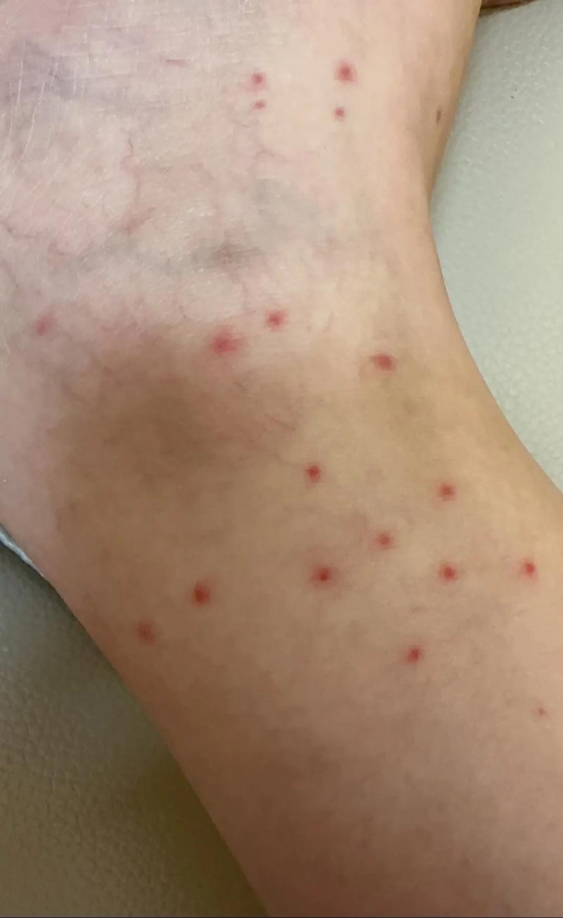 全身皮肤起小红点很痒