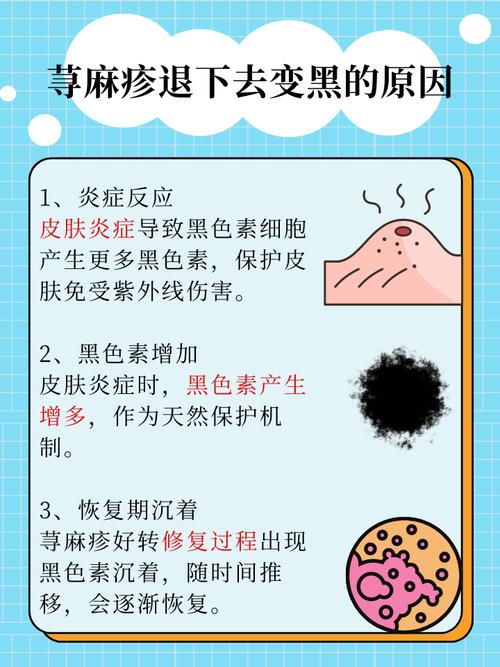 皮肤过敏后变黑,怎么快速恢复原色?