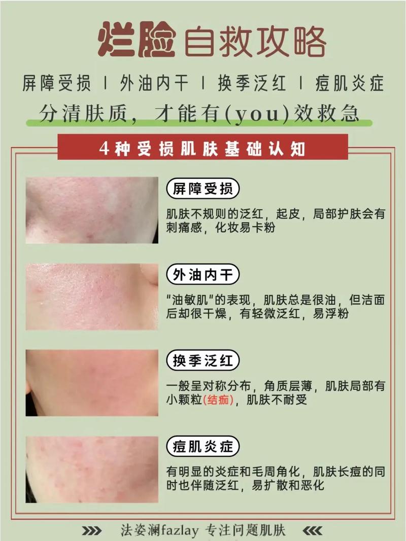 脸上皮肤过敏后,如何快速修复?