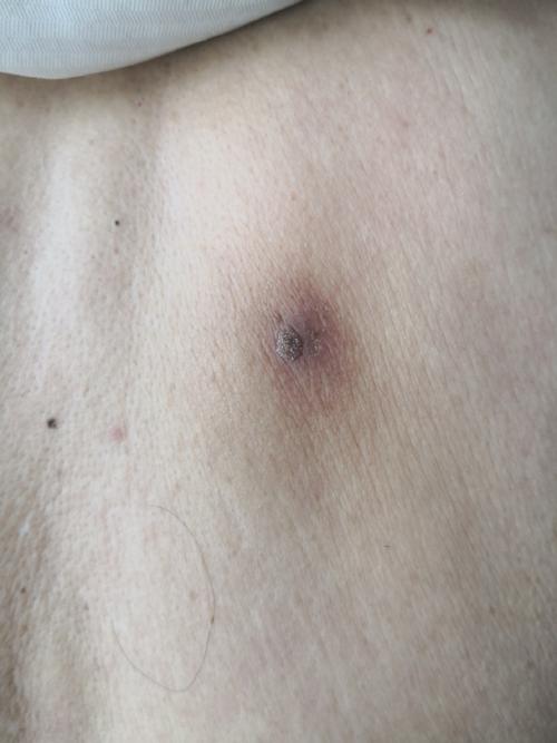 皮肤颜色变深是身体发出的什么信号?