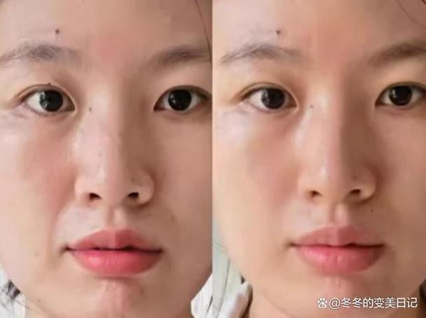 皮肤凹凸不平什么原因