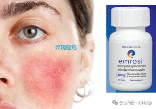 混合性皮肤选什么牌子最合适?