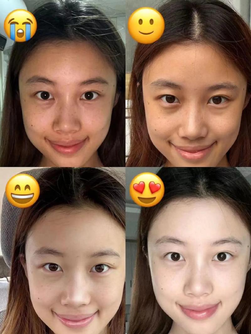 天生黑黄皮怎么有效变白?