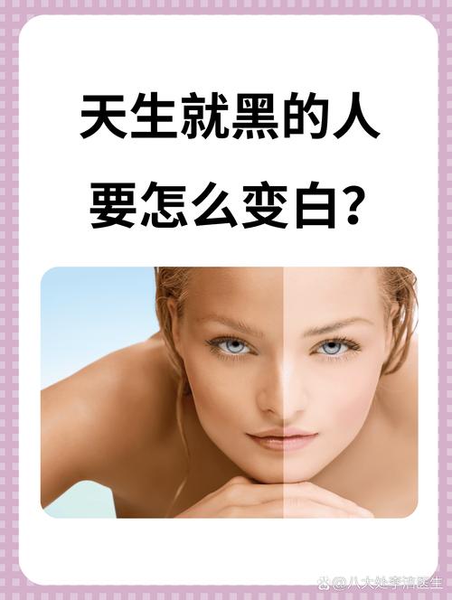 天生黑黄皮怎么有效变白?