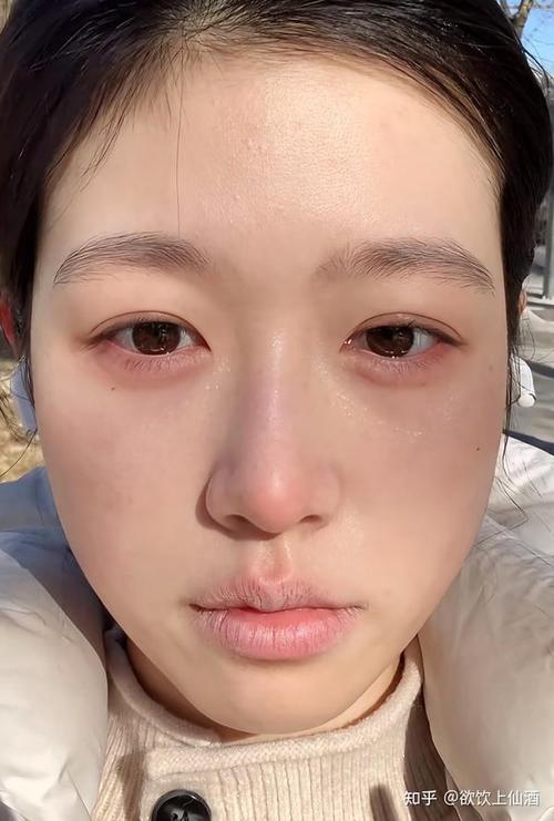 皮肤为何从白变黄?原因何在?