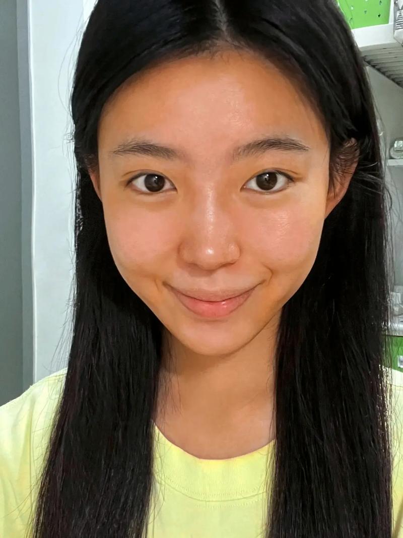 皮肤为何从白变黄?原因何在?