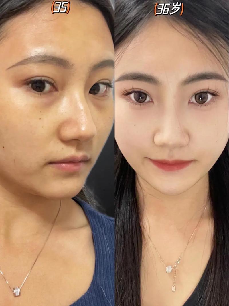 皮肤为何从白变黄?原因何在?