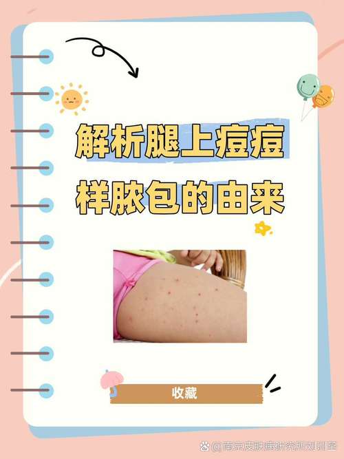 皮肤脓包是感染还是其他问题?