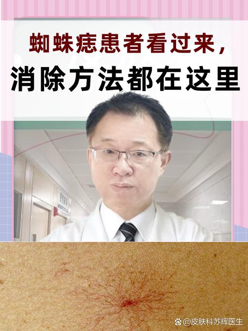 蜘蛛爬过皮肤会残留毒素或引发过敏吗?