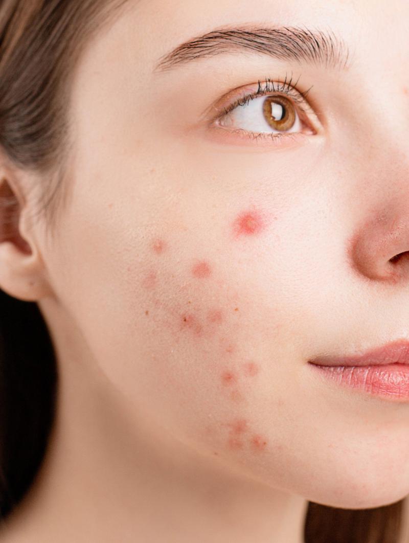 肝不好对皮肤有影响吗