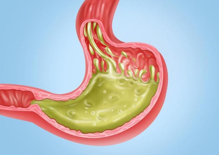 胃酸多该吃啥食物能缓解?