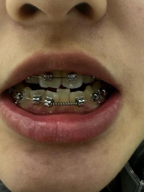 重医附属口腔医院正畸