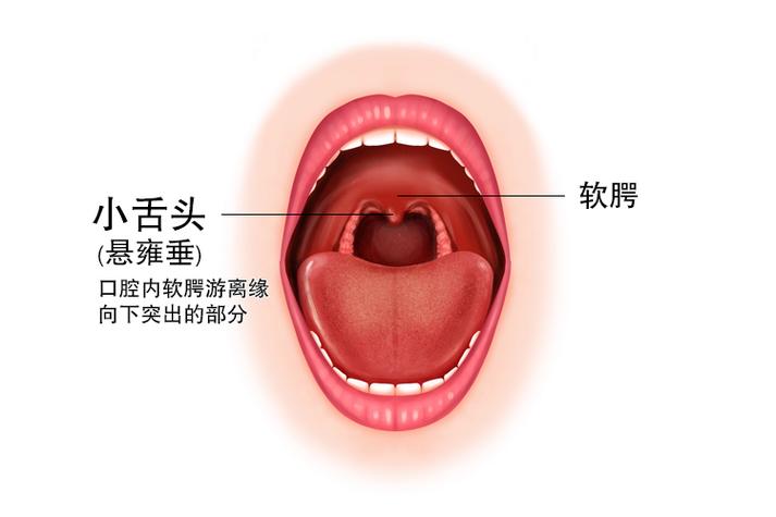 口腔内的小垂是什么?