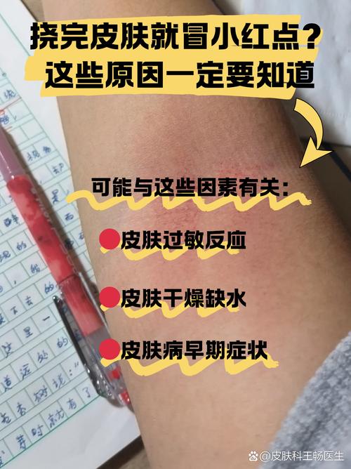 皮肤过敏打针几天消退