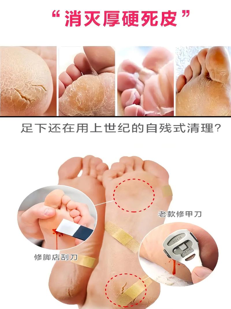 皮肤搓伤如何快速修复