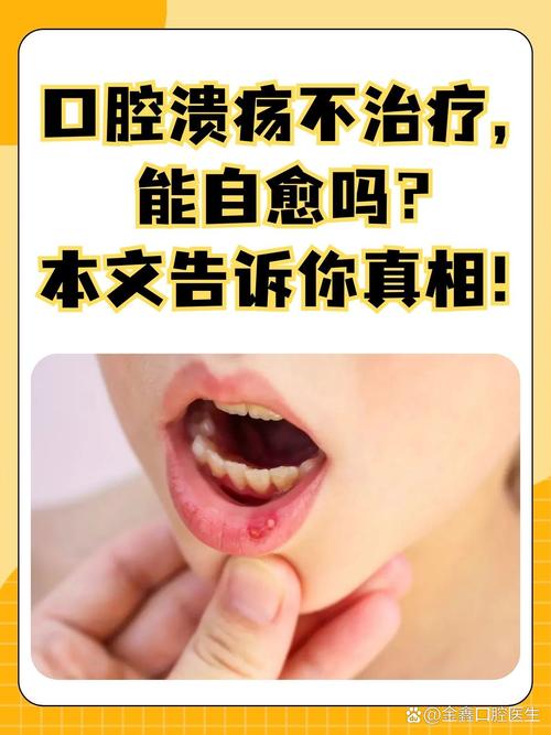 胃炎会引发口腔溃疡吗?