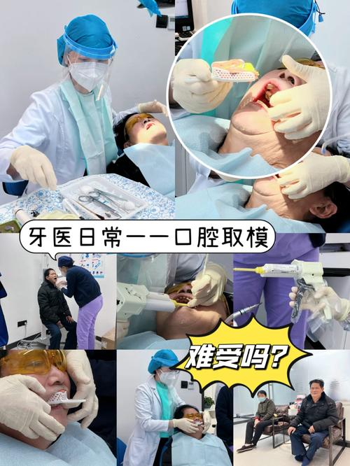 护士口腔取模调模视频如何操作?