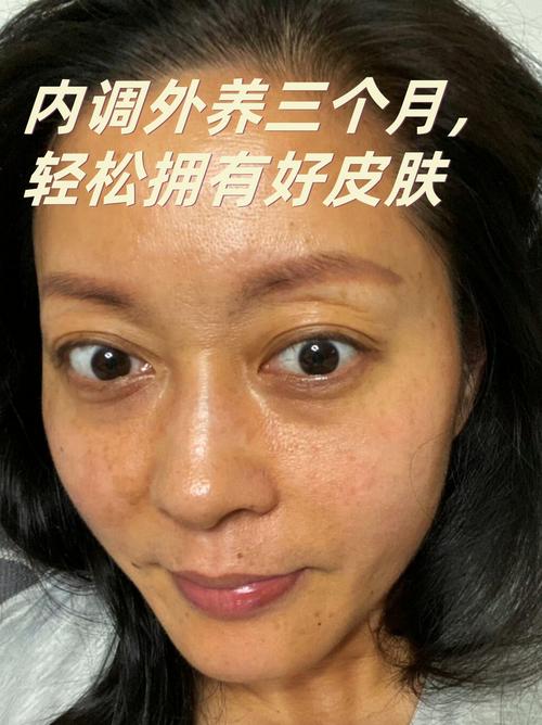 心情差皮肤会变差吗?