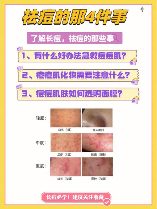 如何有效预防痘痘生成?