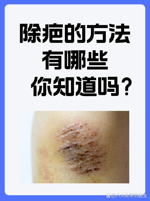 皮肤划伤怎么防止留疤