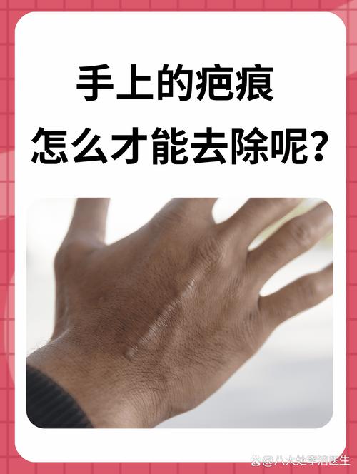 皮肤划伤怎么防止留疤