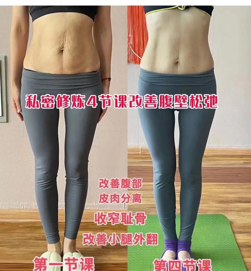 腹部松弛皮肤如何有效收紧?