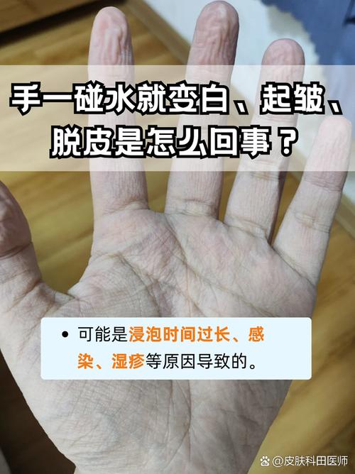 强碱腐蚀皮肤如何紧急处理?