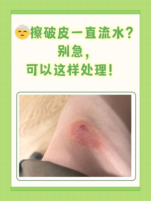 皮肤擦伤化脓怎么处理