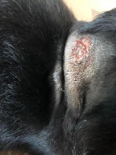 皮肤黑色硬结凸起图片