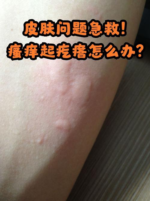 不明原因过敏皮肤瘙痒,究竟如何应对?