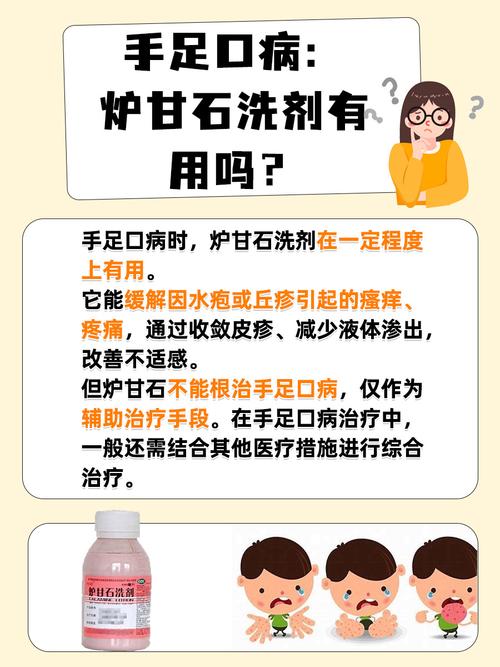 婴儿口腔溃疡用药安全吗?