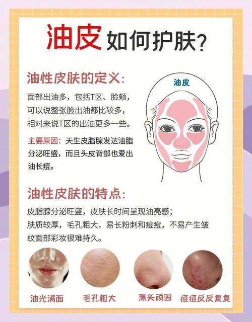 油性皮肤如何正确保养?