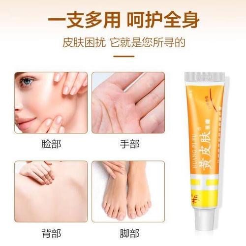 黄皮肤乳膏一支多少钱?