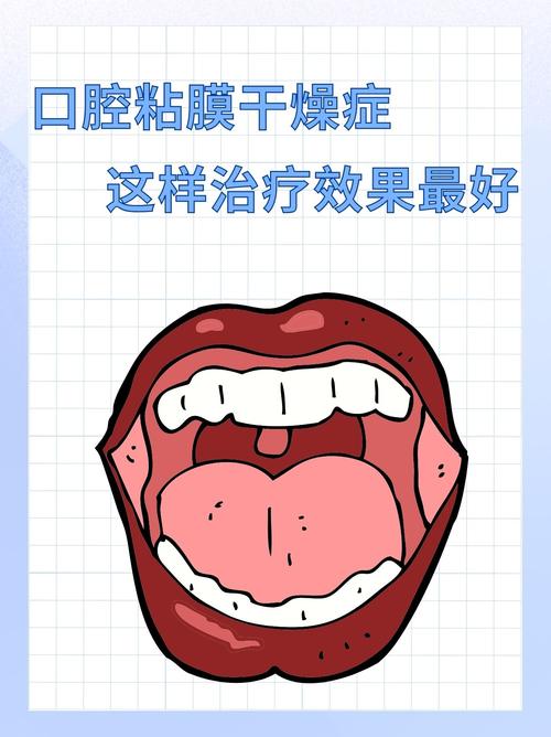 口腔干涩是何因?