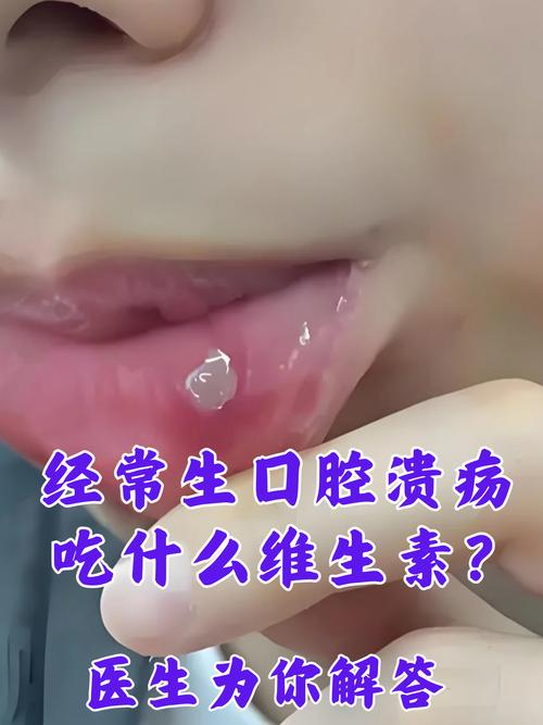 口腔溃疡吃什么能好得快?