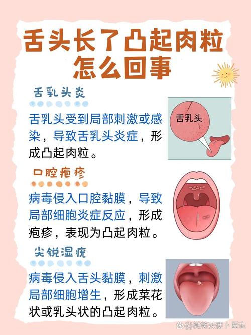 口腔长肉芽是何原因?