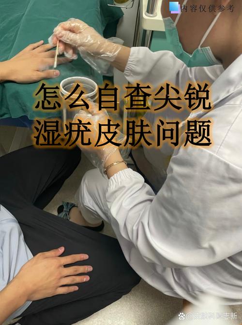 尖锐湿疣是看皮肤科吗