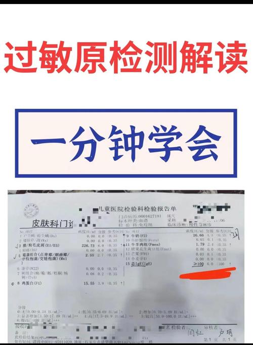 查皮肤过敏源该挂什么科?