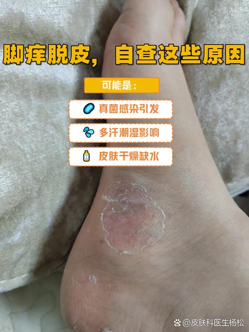 脚腿皮肤痒,究竟是什么原因在作祟?